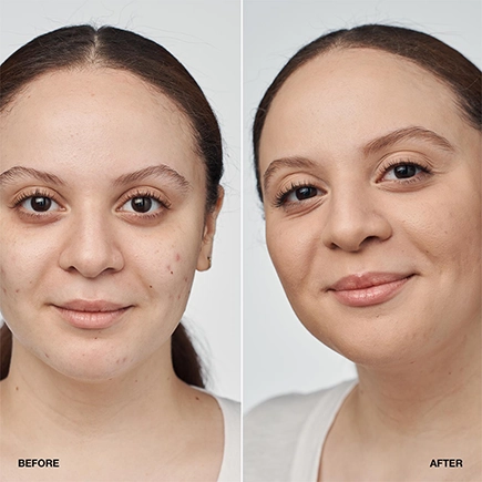 Clinique Even Better Clinical Serum Foundation SPF20
