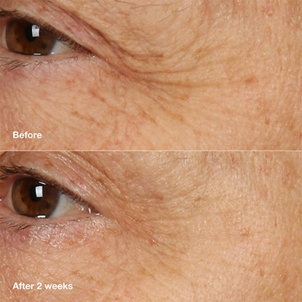 Clinique Smart Clinical Repair Overnight Cream & Mask
