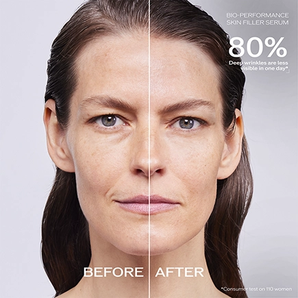 Shiseido Skin Filler Refill