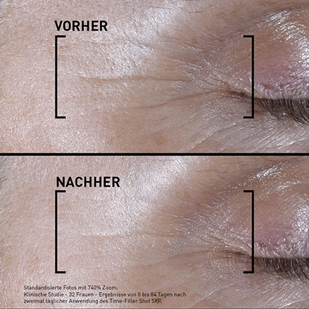 Filorga TIME-FILLER SHOT 5XP Serum zur Korrektur von Mimikfalten