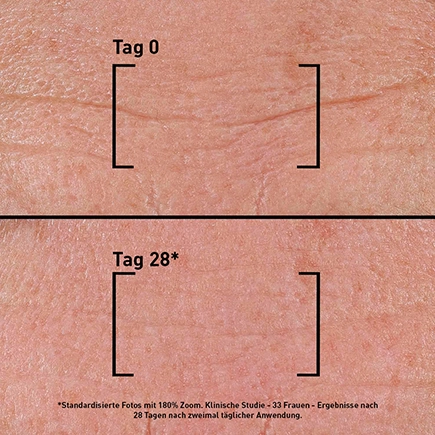 Filorga TIME-FILLER INTENSIVE 5XP Intensiv glättendes Serum