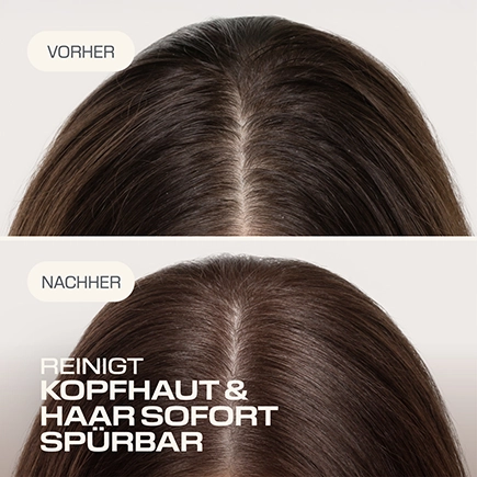 Goldwell. SCALP SPECIALIST Tiefenreinigendes Shampoo