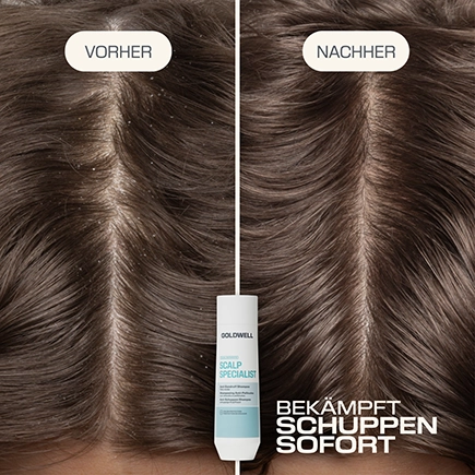 Goldwell. SCALP SPECIALIST Anti-Schuppen Shampoo
