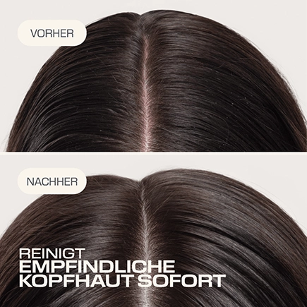 Goldwell. SCALP SPECIALIST Sensitive Schaum Shampoo