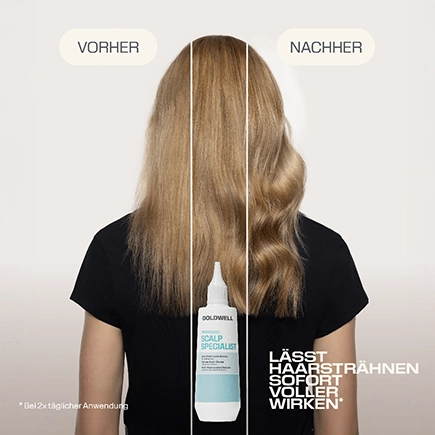 Goldwell. SCALP SPECIALIST Anti-Haarausfall Serum