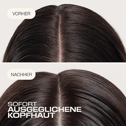 Goldwell. SCALP SPECIALIST Kopfhaut Balance & Feuchtigkeitsfluid