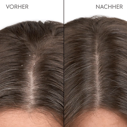 Kerasilk Anti-Schuppen Shampoo