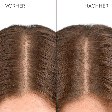 Kerasilk Feuchtigkeitsspendende Kopfhaut Drops