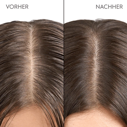Kerasilk Kopfhaut & Haar Peeling