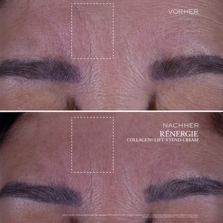 Lancôme Rénergie Collagen Lift Xtend